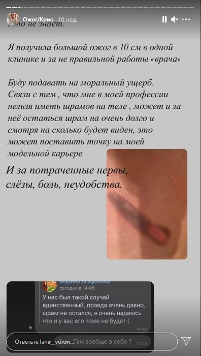 ожог.jpg ожог.jpg